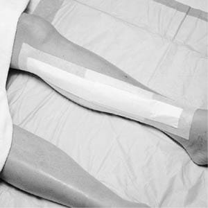 A person laying on a bed with a bandage on their leg.