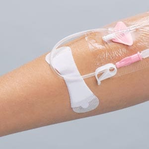 A woman's arm with an iv drip attached to it.