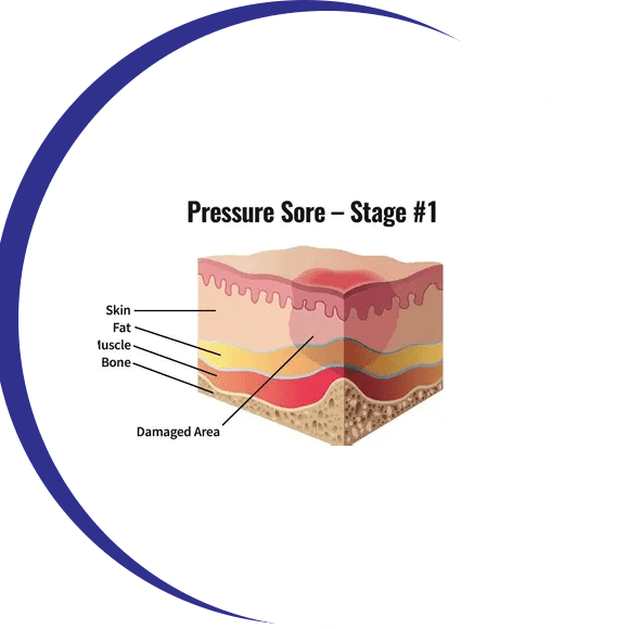 A cross section of the skin shows how pressure is measured.