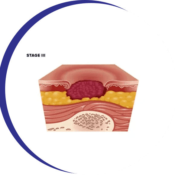 A cross section of the skin shows the layers.